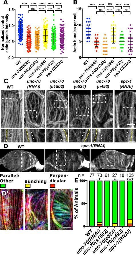 Spectrin Is Required For Prominent Central Actin Bundles And Actin