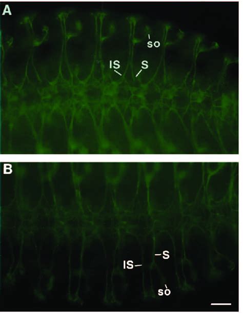 glide induces defects in axonal growth. Stage 15 embryos, ventral view ...