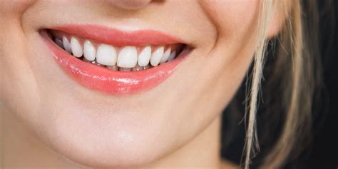 Mes dents ont bougé après un traitement orthodontique que faire