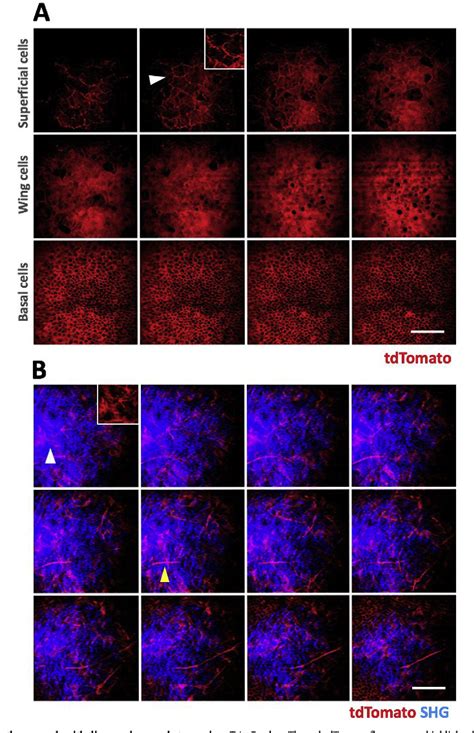 Figure 1 From Intravital Multiphoton Microscopic Imaging Platform For Ocular Surface Imaging