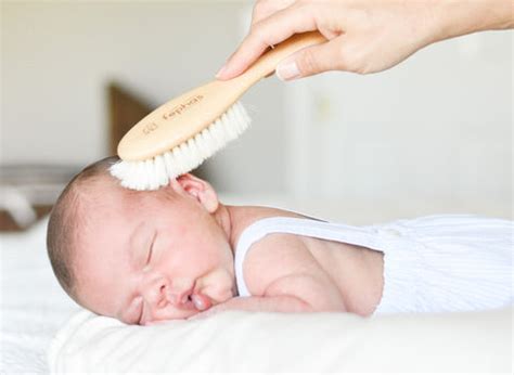 Cradle Cap Treatment: Best Tips for New Parents – fephas