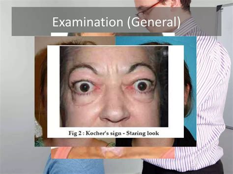 Thyroid Examination Ppt