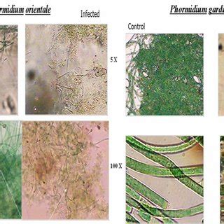 Lytic of Phormidium orientale and Phormidium gardneri cells viewed with... | Download Scientific ...