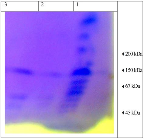 Sds Page Of Glucose Aerodehydrogenase Lane Is Marker And Purified