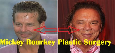 Mickey Rourke Before And After