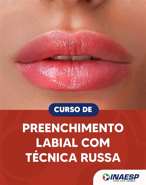 Curso 100 Online De Preenchimento Labial Com Técnica Russa