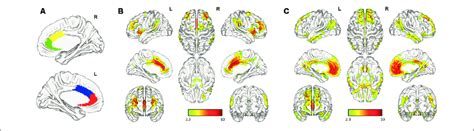 | Functional connectivity of anterior cingulate cortex (ACC ...