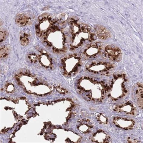 Beta 1 4 Galactosyltransferase 2 B4GalT2 Antibody Novus Biologicals 0