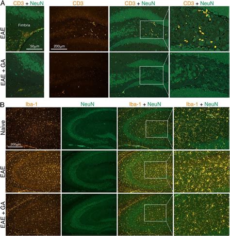 The effect of EAE induction and GA-treatment on hippocampus ... 