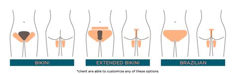 Bikini Vs Brazilian Diagram