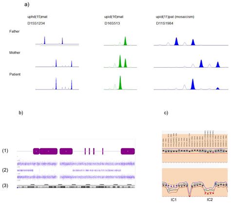 Genes Free Full Text Prenatal Detection Of Uniparental Disomies