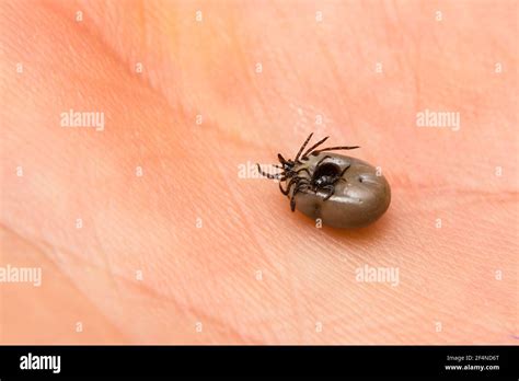 Close Up Photo Of A Tick Couple Male And Female On Human Skin Stock