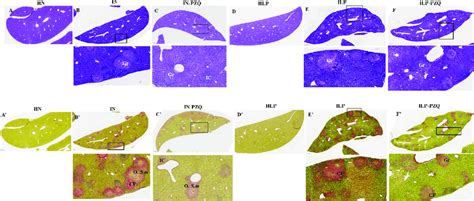 Effects of praziquantel treatment on the liver histology of Schistosoma... | Download Scientific ...