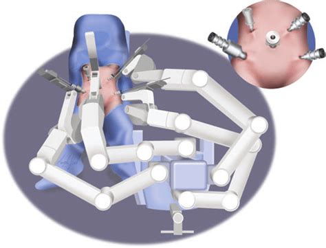 Standard Arm Da Vinci Intuitive Surgical Inc Sunnyvale Ca