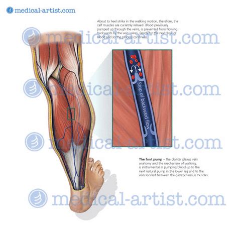 Anatomical Medical Illustrations And Medical Legal Illustration By Medical Artist Joanna Culley