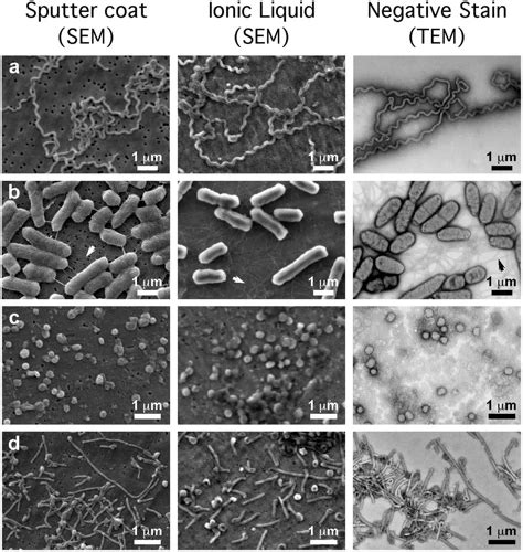 What is the Difference Between a TEM and SEM Microscope? Find Out Now!