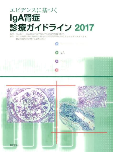 楽天ブックス エビデンスに基づくiga腎症診療ガイドライン（2017） 丸山彰一 9784885632815 本