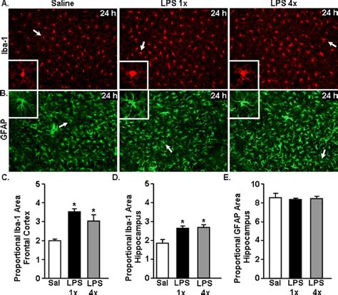 Increased Iba 1 Immunoreactivity Of Microglia 24 H After Acute And