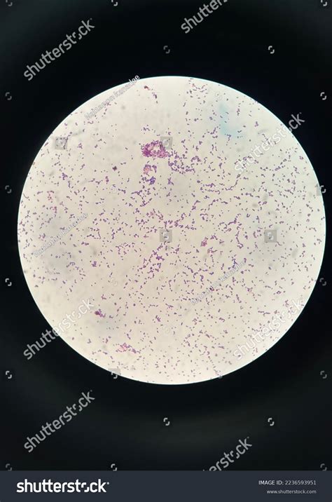 Bacteria Gram Positive Cocci Microscope Stock Photo 2236593951 ...