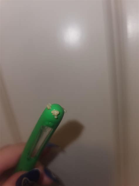 Tonsil stones from one Tonsil : r/tonsilstones