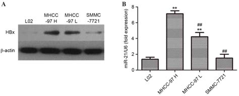 Hepatitis B Virus X Protein Increases Microrna‑21 Expression And