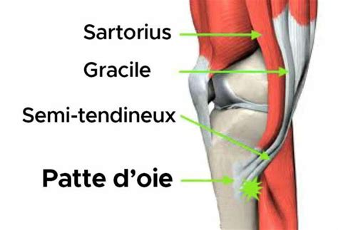 Tendinite de la patte d oie Exercices et remèdes naturels Remèdes