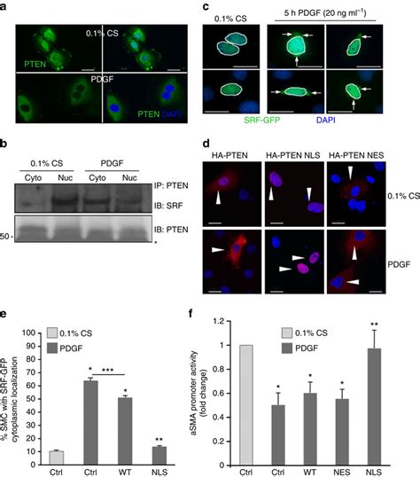 Nuclear PTEN Blocks PDGF Mediated Repression Of SM Gene Transcription