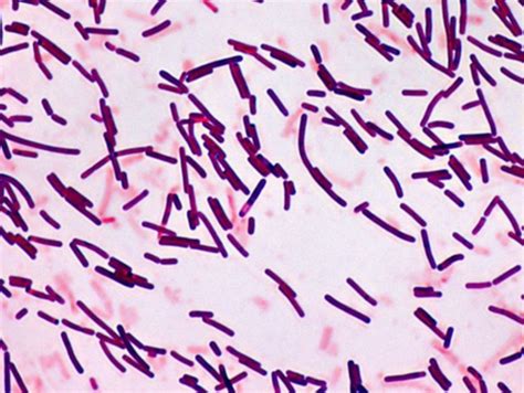 microbiology - Are acid-fast bacteria Gram-positive or Gram-negative ...