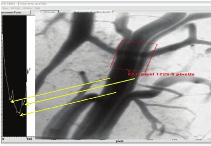 Screen Picture OPS Image Of The Brain Microvascular Bed 3 Venules