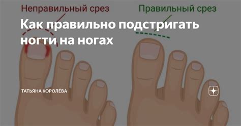 Как правильно подстригать ногти на ногах | Татьяна Королёва | Дзен