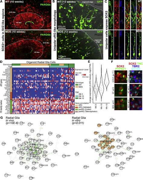 Human Ipsc Derived Cerebral Organoids Model Cellular Features Of