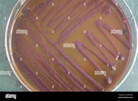 Petri Dish With Various Bacteria Colonies On Agar Stock Photo Alamy