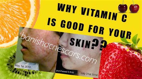 What Is Vitamin C And How Does It Work For Your Skin Dml Style Youtube