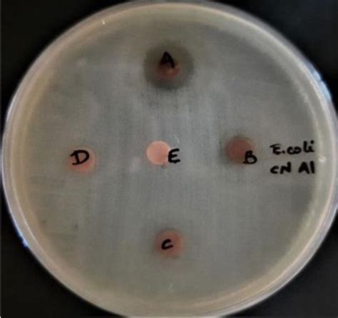 Figure 4 From Assessment Of In Vitro Antibacterial Activity And MIC Of