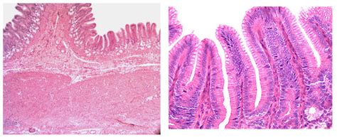 Stomach histology Diagram | Quizlet