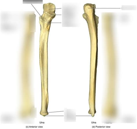 Ulna Diagram | Quizlet