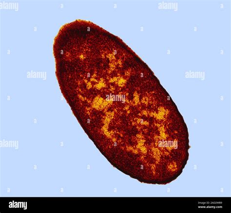 Colored Transmission Electron Micrograph Tem Of A Section Through An