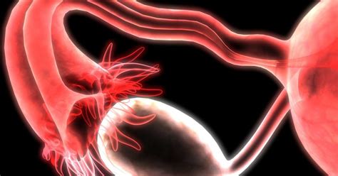 Enlarged ovaries: Symptoms, causes, and treatment