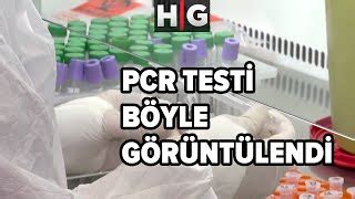 Pcr Testi Ne Demek Buterfly Dental