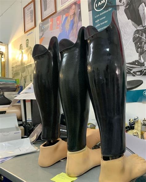 Протез голени в России на заказ - Проект "Про Ноги"