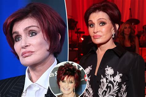 Sharon Osbourne Before And After