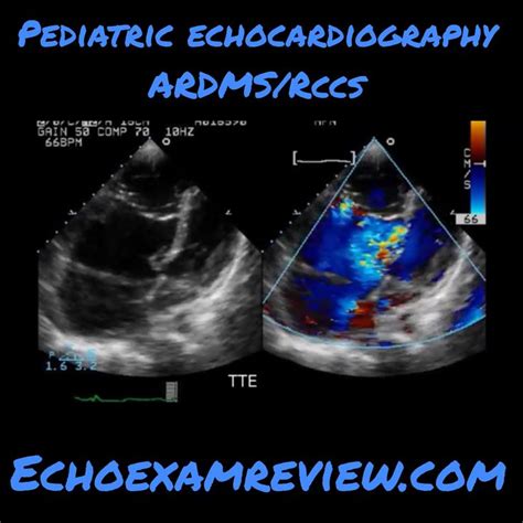 Pediatric Echocardiography | Pediatrics, Movie posters, Poster