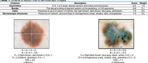 Table 1 From Visual Feature Extraction From Dermoscopic Colour Images