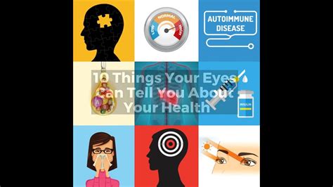 10 Things Your Eyes Can Tell You About Your Health Youtube