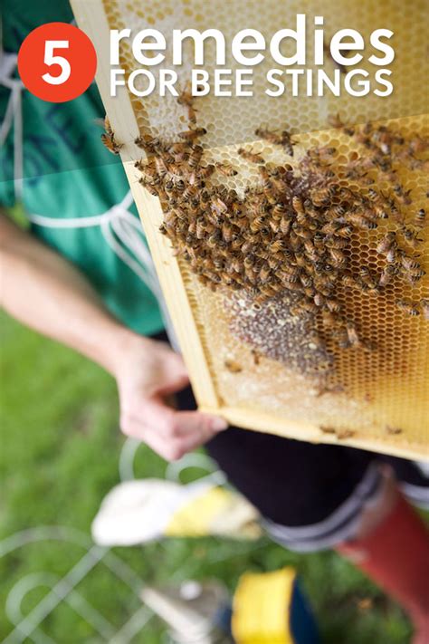 5 Effective Home Remedies for Bee Stings