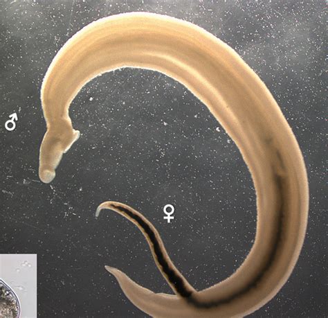 Schistosoma Haematobium Un Parásito Que Produce Cáncer De Vejiga