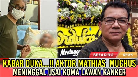 Kabar Duka Innalillahi Aktor Mathias Muchus Alami Koma Meninggal