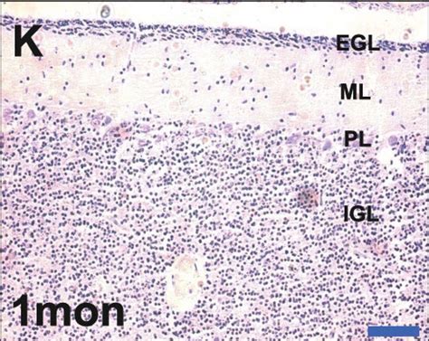 Neural - Cerebellum Development - Embryology