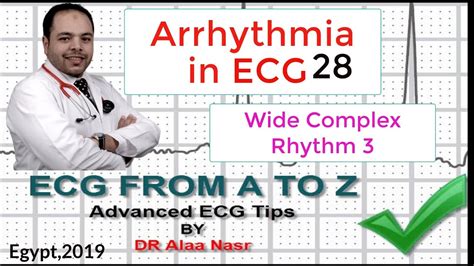 ECG From A To Z Intermediate Level Arrhythmia 28 Dr Alaa Nasr 2019