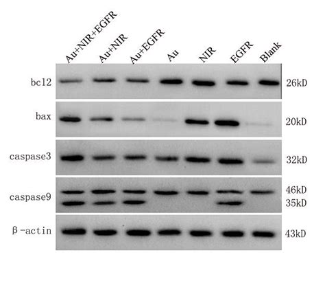 Western Blot Analysis Technique In Detecting Protein Expression Level